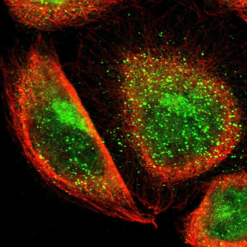 Staining of human cell line A-431 shows localization to nucleoplasm, the Golgi apparatus & vesicles.