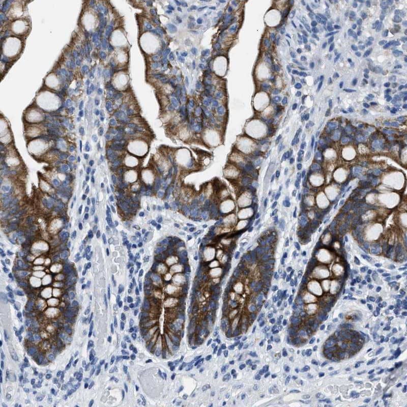 Immunohistochemistry-Paraffin MRPL39 Antibody - BSA Free