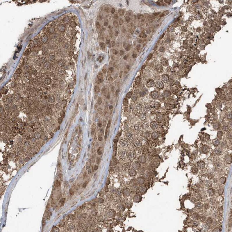 Immunohistochemistry-Paraffin GCFC1 Antibody - BSA Free