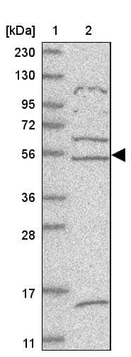Lane 1: Marker [kDa] 230, 130, 95, 72, 56, 36, 28, 17, 11Lane 2: Human cell line RT-4