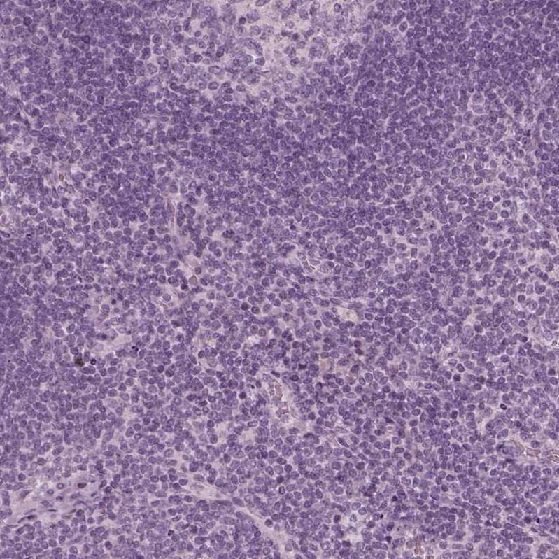 Immunohistochemistry-Paraffin ZP4 Antibody - BSA Free