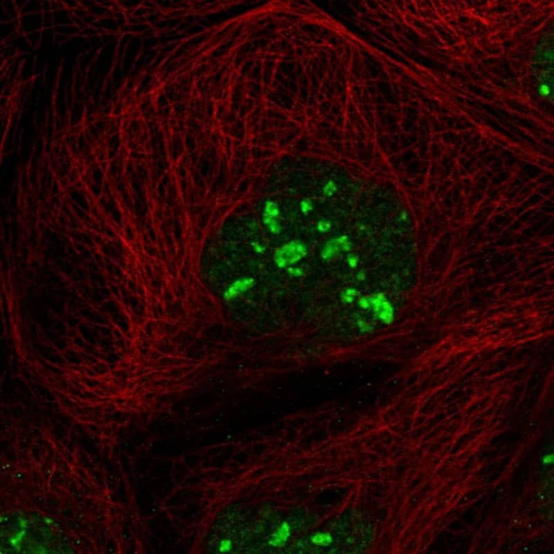 Staining of human cell line A-431 shows localization to nucleus & nucleoli.