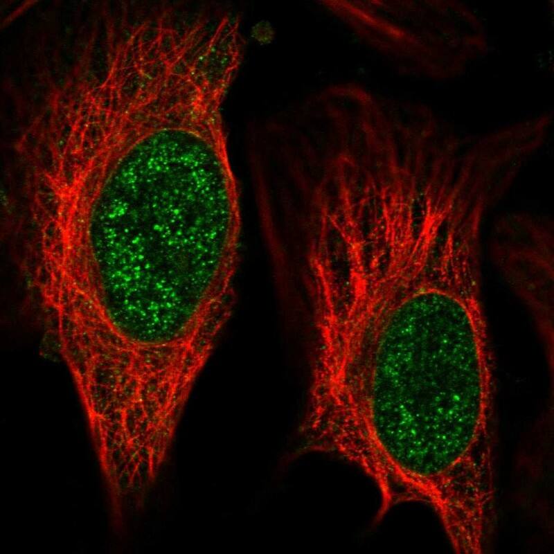 Immunocytochemistry/ Immunofluorescence ZNF653 Antibody - BSA Free