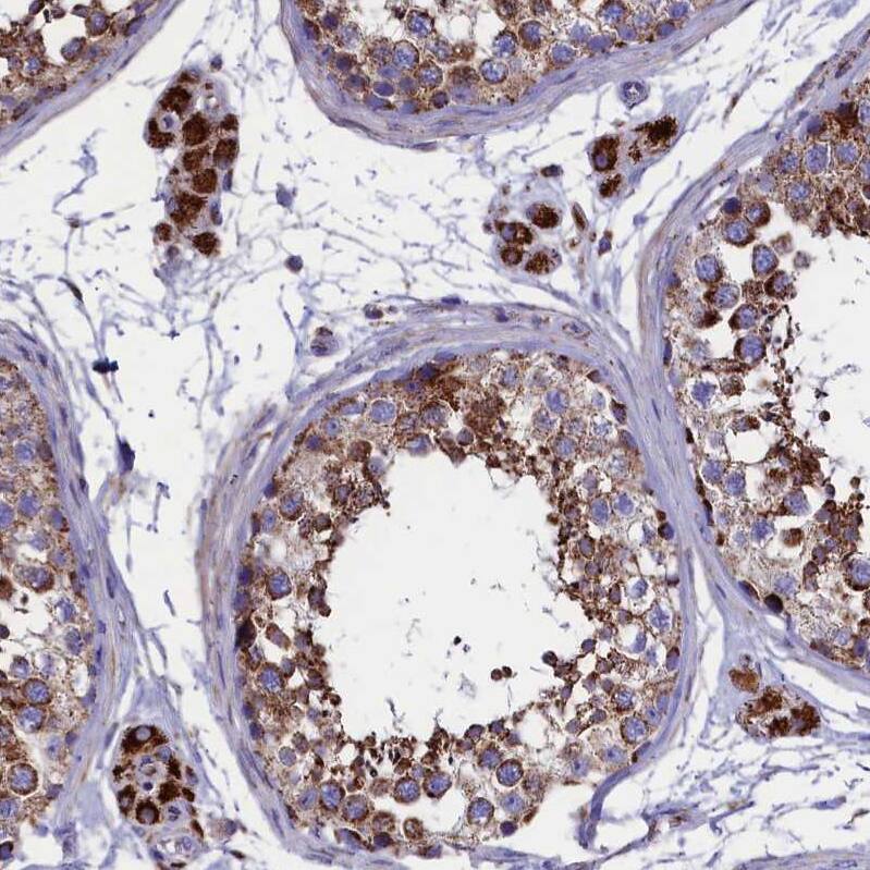 Immunohistochemistry-Paraffin SLC39A3 Antibody - BSA Free