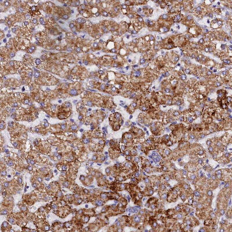 Immunohistochemistry-Paraffin SLC39A3 Antibody - BSA Free