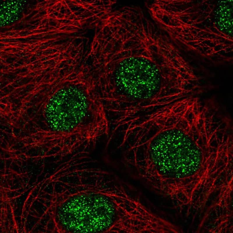 Immunocytochemistry/ Immunofluorescence ZIC1 Antibody - BSA Free