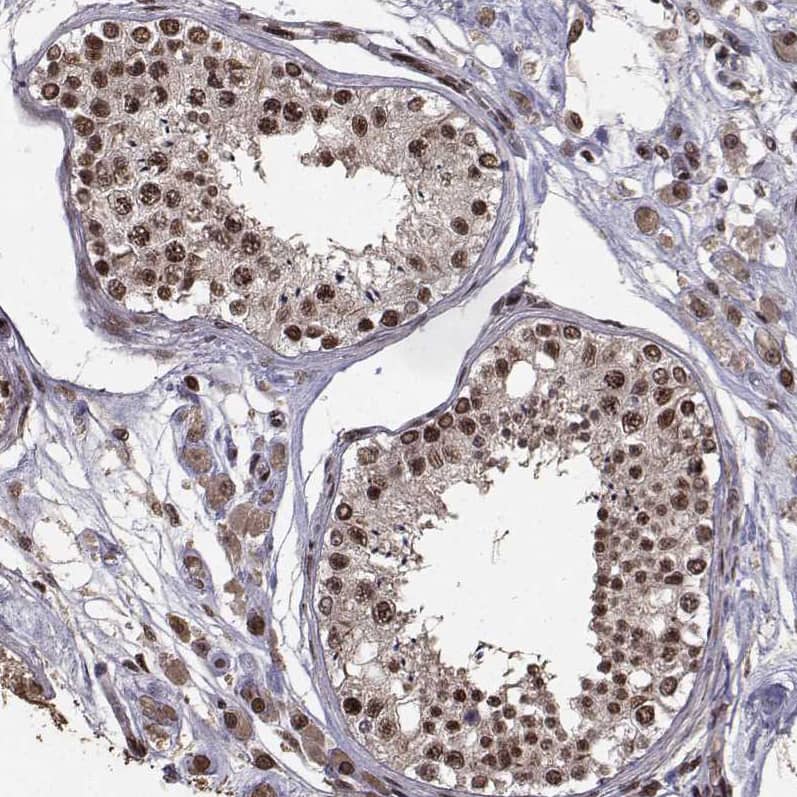 Staining of human testis shows moderate to strong nuclear positivity in cells in seminiferous ducts.