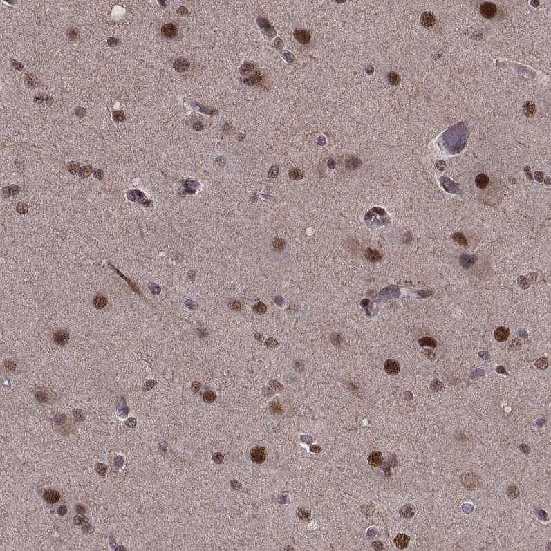 Staining of human cerebral cortex shows moderate to strong nuclear positivity in neuronal cells.