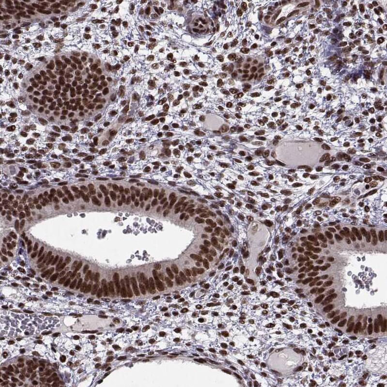 Staining of human endometrium shows moderate to strong nuclear positivity in glandular cells.