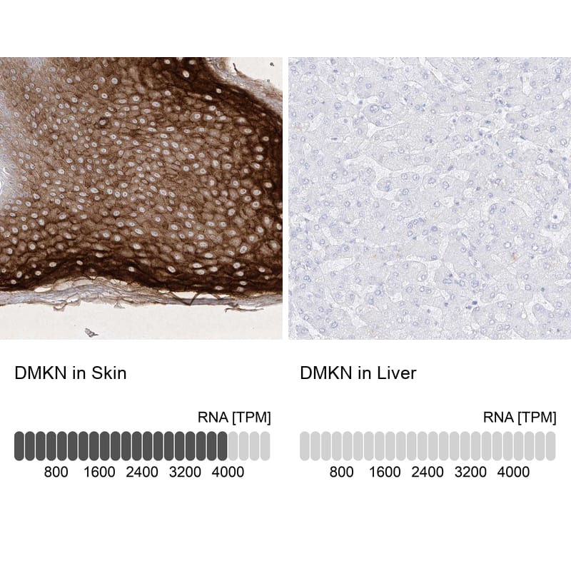 <b>Orthogonal Strategies Validation. </b>Analysis in human skin and liver tissues Corresponding DMKN RNA-seq data are presented for the same tissues.