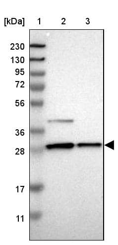 Lane 1: Marker [kDa] 230, 130, 95, 72, 56, 36, 28, 17, 11Lane 2: Human cell line RT-4Lane 3: Human cell line U-251MG sp