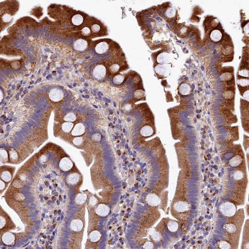 Immunohistochemistry-Paraffin LSM4 Antibody - BSA Free