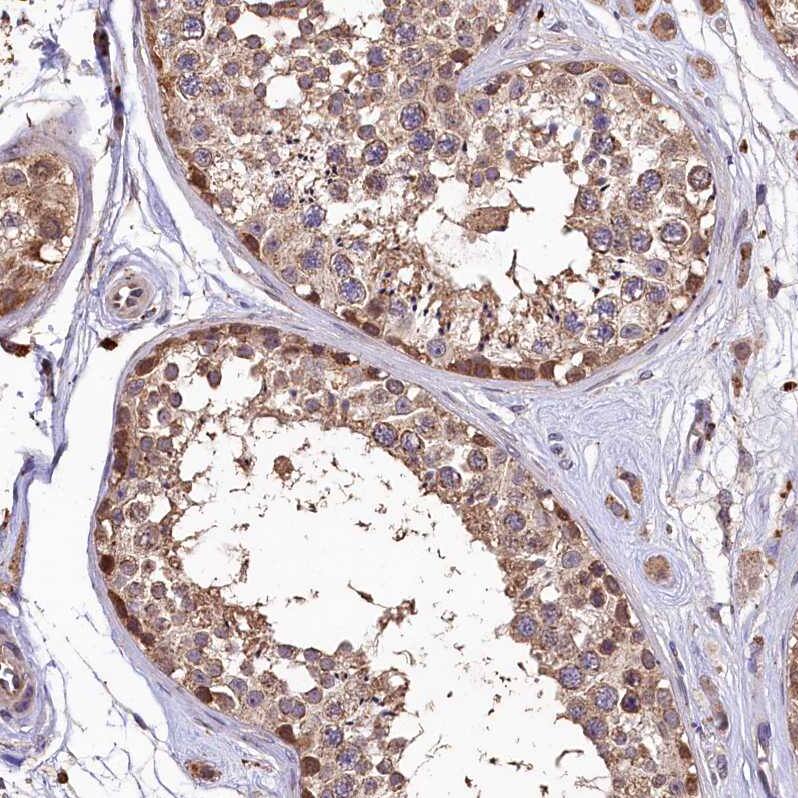 Immunohistochemistry-Paraffin LSM4 Antibody - BSA Free