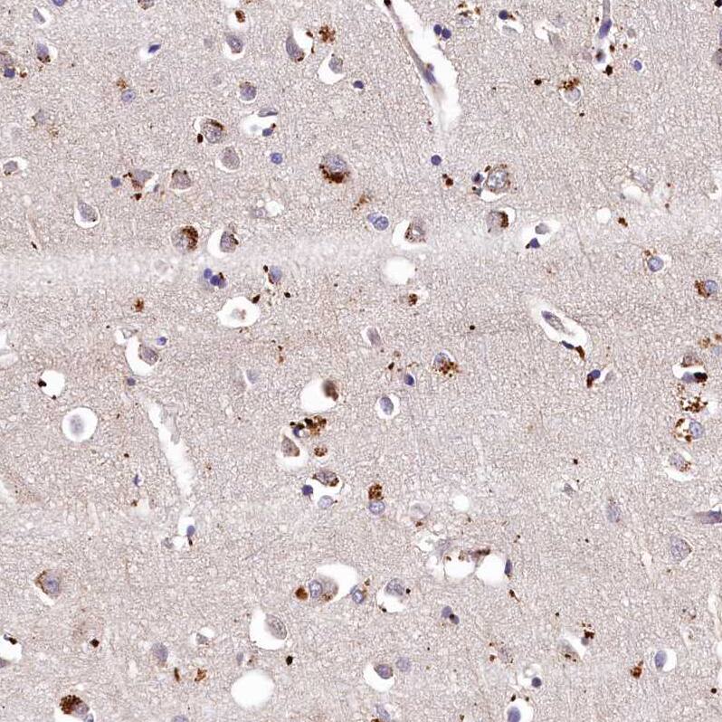 Immunohistochemistry-Paraffin LSM4 Antibody - BSA Free