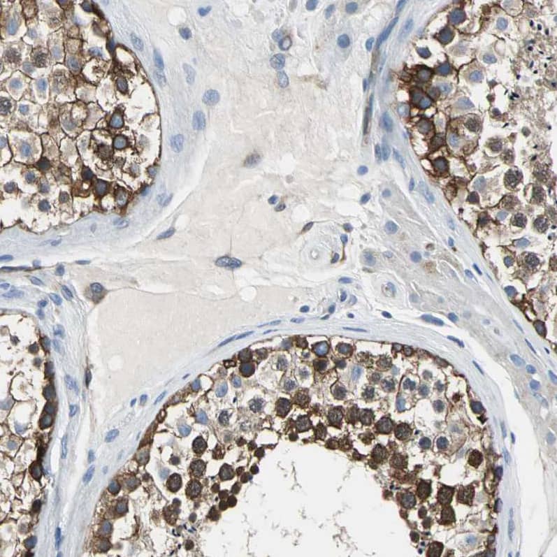 Staining of human testis shows strong membranous and cytoplasmic positivity in cells in seminiferous ducts.