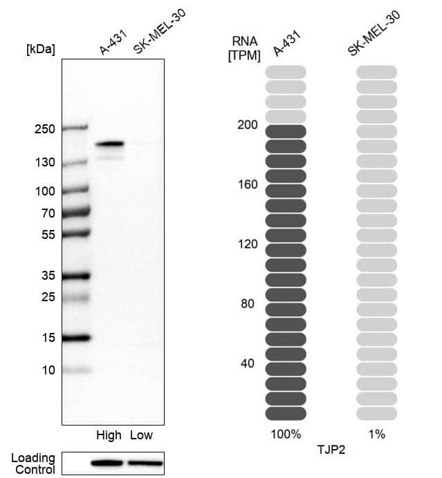 <b>Orthogonal Strategies Validation. </b>Analysis in human cell lines A-431 and SK-MEL-30 using Anti-TJP2 antibody. Corresponding TJP2 RNA-seq data are presented for the same cell lines. Loading control: Anti-HSP90B1.