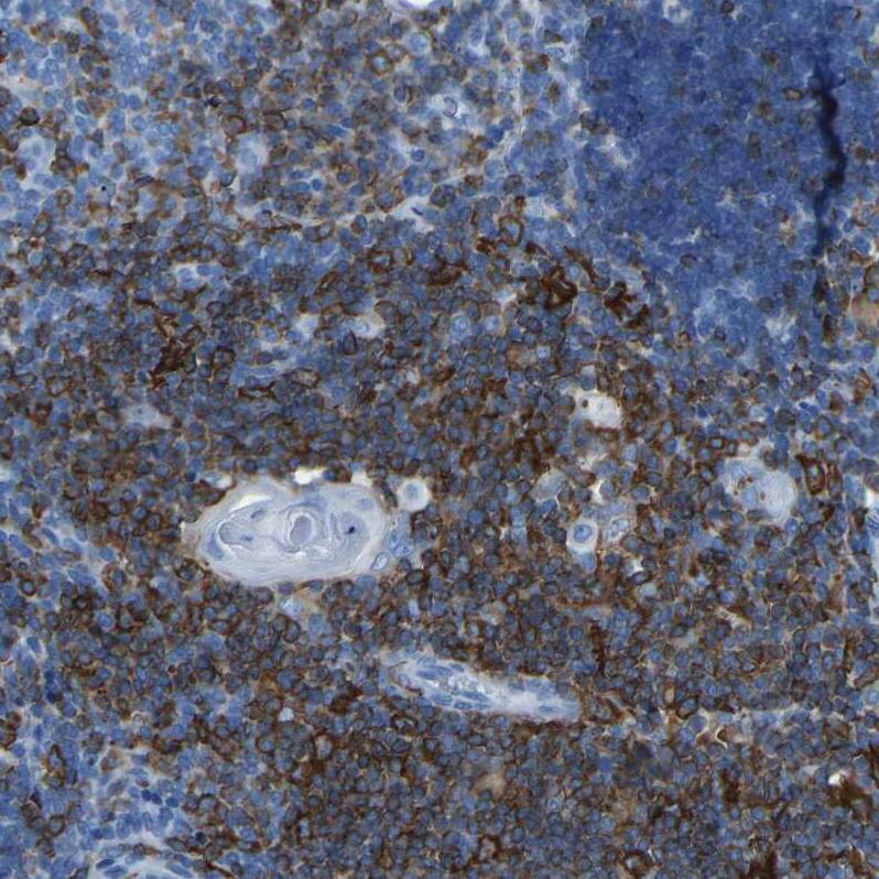 Staining of human lymph node shows strong membranous positivity in non-germinal center cells.
