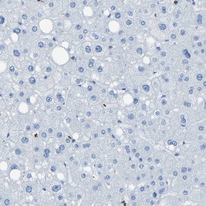 Staining of human liver shows no positivity in hepatocytes as expected.