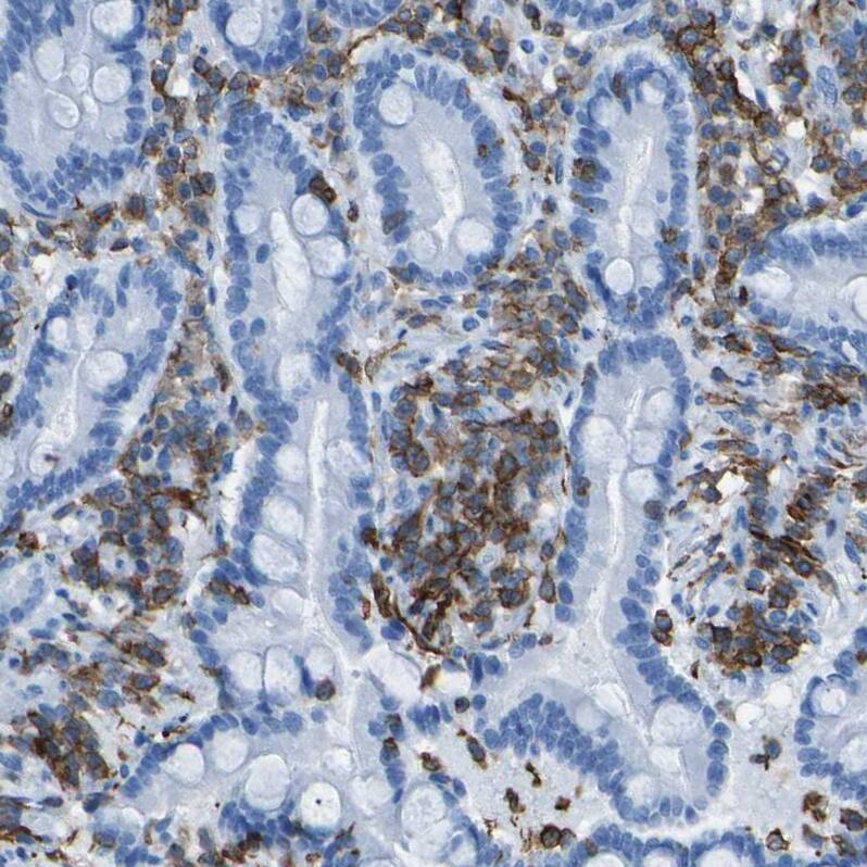 Staining of human duodenum shows strong membranous positivity in lymphoid cells.