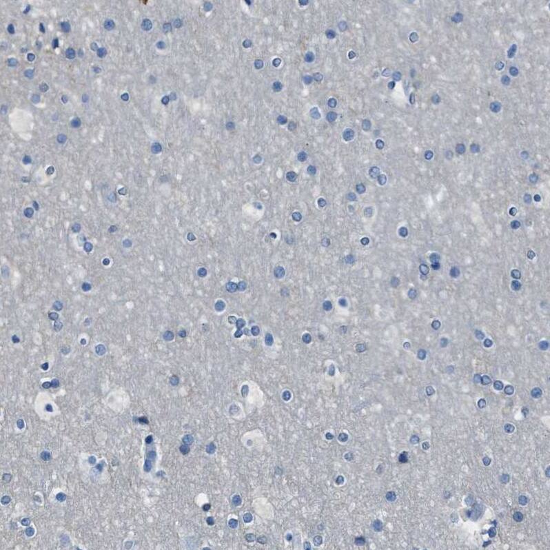 Staining of human cerebral cortex shows no positivity in neurons as expected.