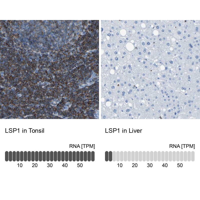 Immunohistochemistry-Paraffin LSP1 Antibody - BSA Free