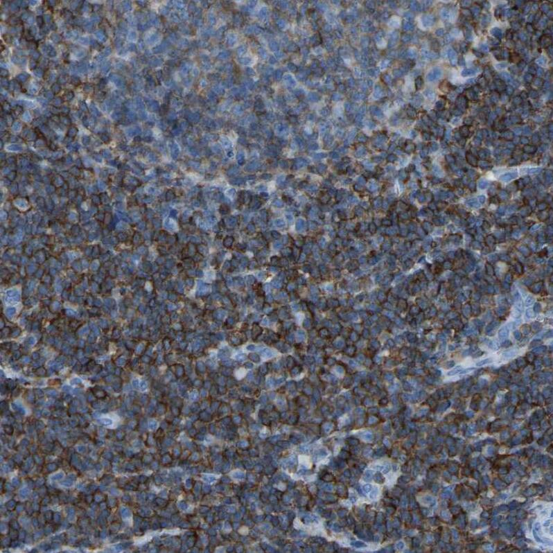 <b>Orthogonal Strategies Validation. </b>Staining of human tonsil shows strong membranous positivity in non-germinal center cells.