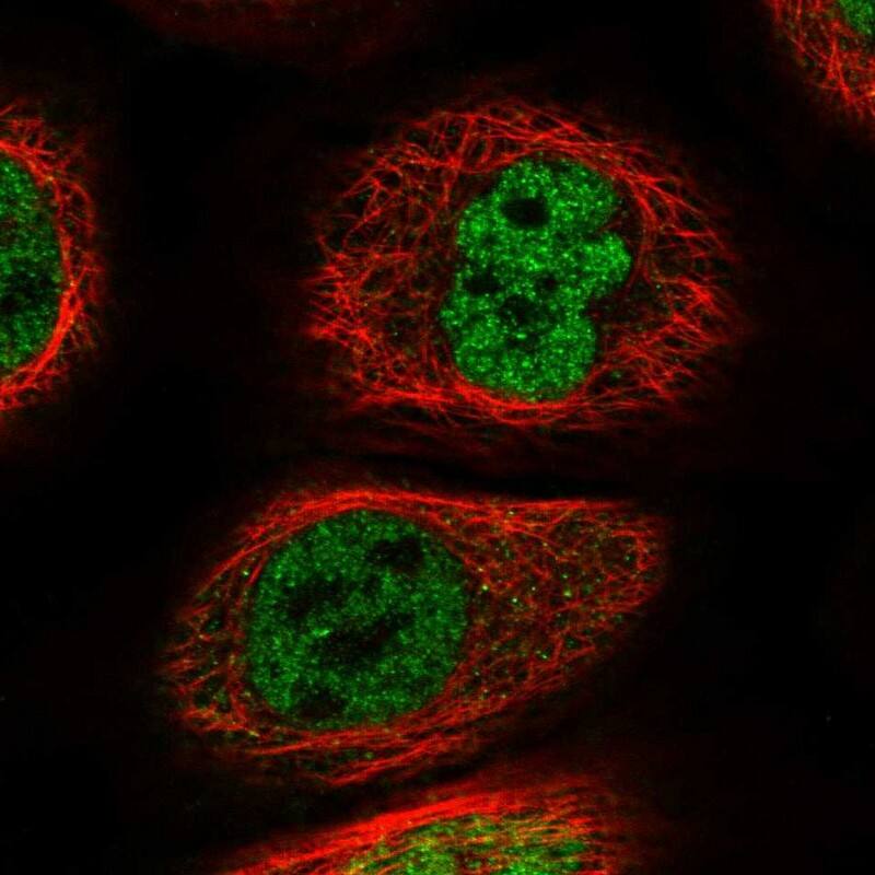 Immunocytochemistry/ Immunofluorescence WIRE Antibody - BSA Free