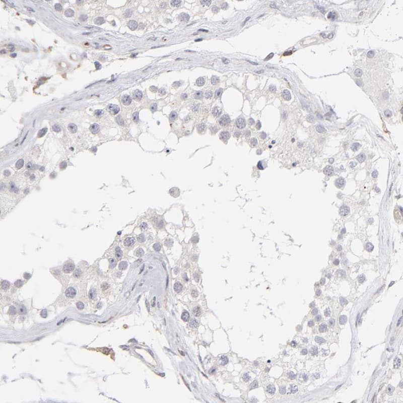 Immunohistochemistry-Paraffin WIPF1/WIP Antibody - BSA Free