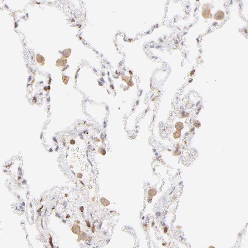 Immunohistochemistry-Paraffin WIPF1/WIP Antibody - BSA Free