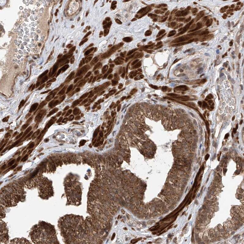Staining of human prostate shows strong cytoplasmic positivity in smooth muscles and glandular cells.