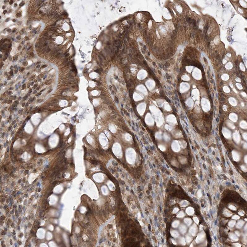 Staining of human rectum shows moderate cytoplasmic positivity in glandular cells.