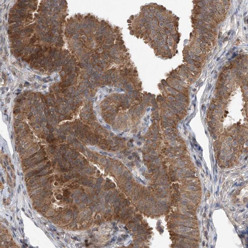 Staining of human fallopian tube shows moderate cytoplasmic positivity in glandular cells.