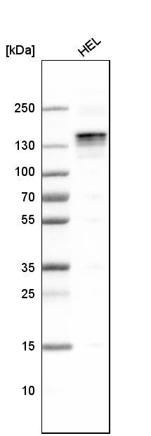 Analysis in human cell line HEL.