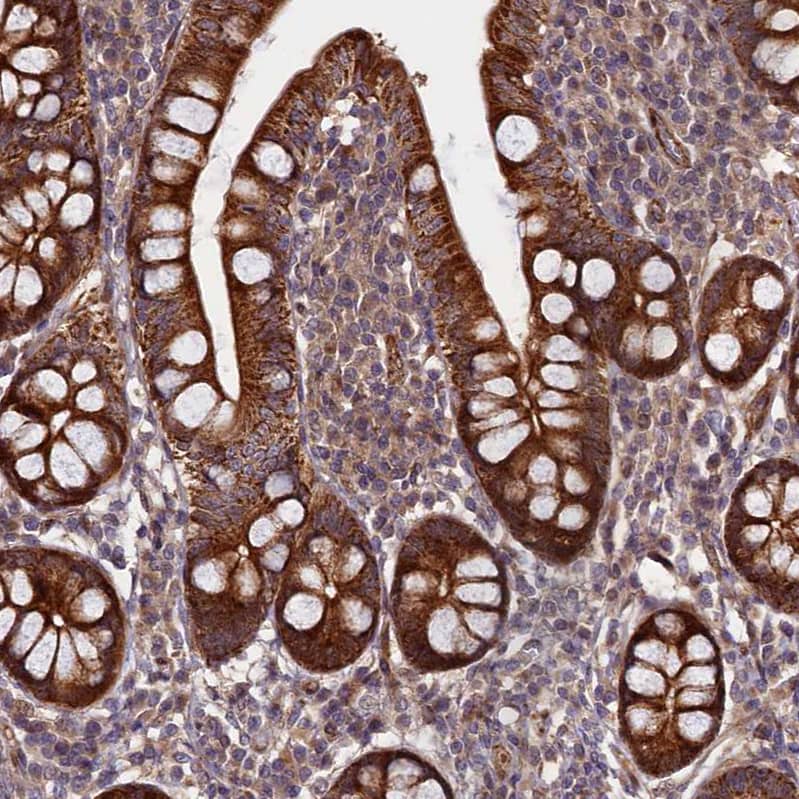 Staining of human small intestine shows strong cytoplasmic positivity in glandular cells.