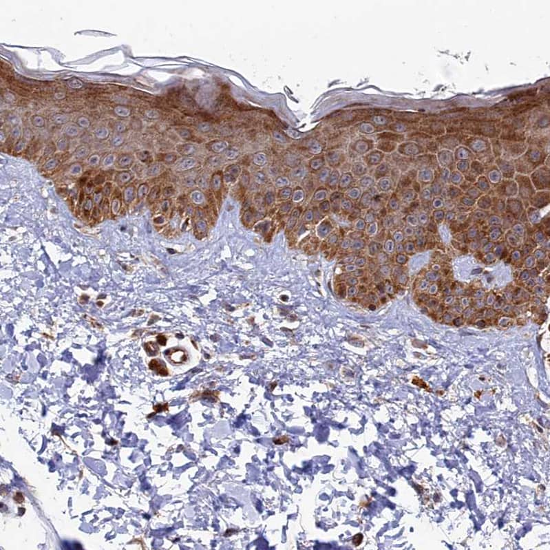 Staining of human skin shows moderate cytoplasmic positivity in squamous epithelial cells.