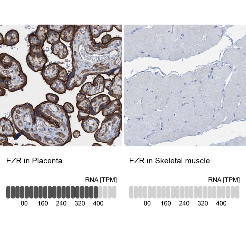 <b>Orthogonal Strategies Validation. </b>Analysis in human placenta and skeletal muscle tissues Corresponding EZR RNA-seq data are presented for the same tissues.