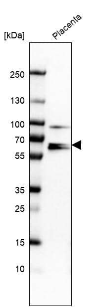 Analysis in human placenta tissue.