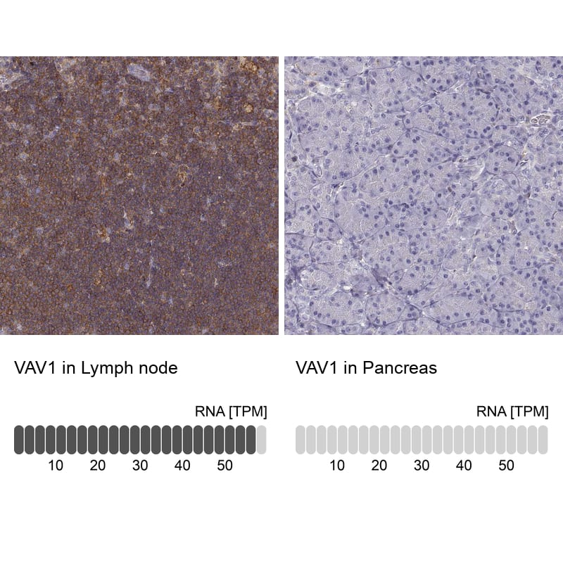 <b>Orthogonal Strategies Validation. </b>Analysis in human lymph node and pancreas tissues Corresponding VAV1 RNA-seq data are presented for the same tissues.