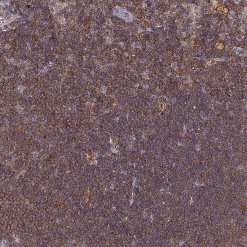 Staining of human lymph node shows strong cytoplasmic positivity in non-germinal center cells.