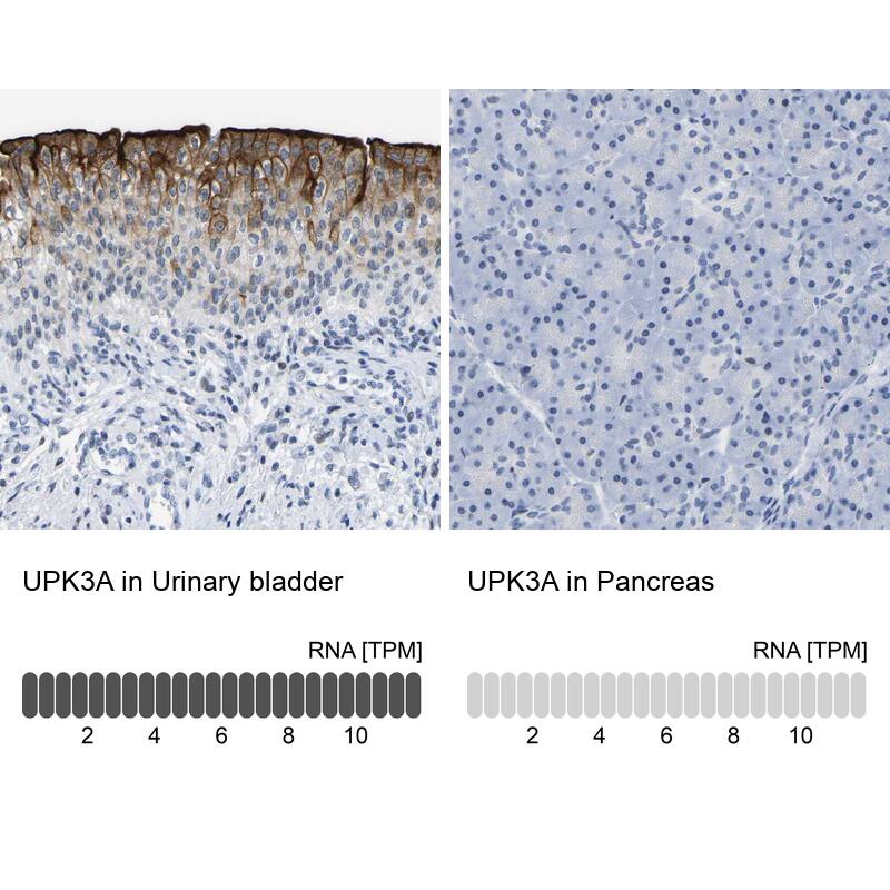 Immunohistochemistry-Paraffin Uroplakin III Antibody - BSA Free