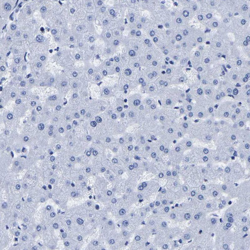 Staining of human liver shows no positivity in hepatocytes as expected.