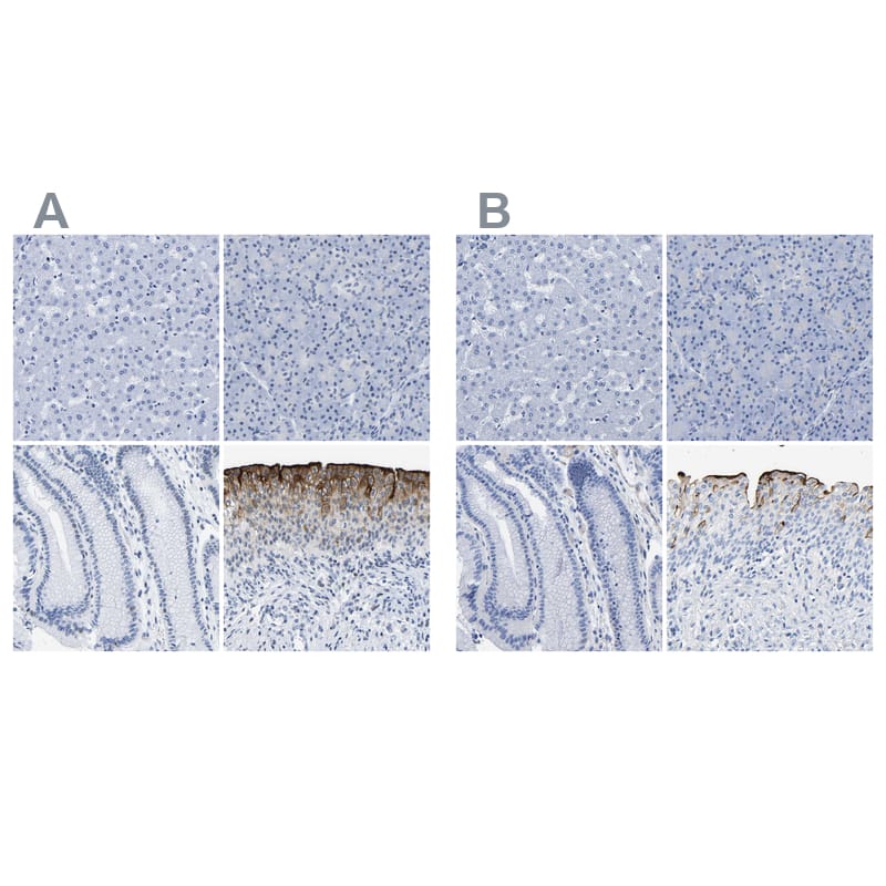 <b>Independent Antibodies Validation. </b>Staining of human liver, pancreas, stomach and urinary bladder using Anti-UPK3A antibody NBP1-86873 (A) shows similar protein distribution across tissues to independent antibody NBP1-86874 (B).