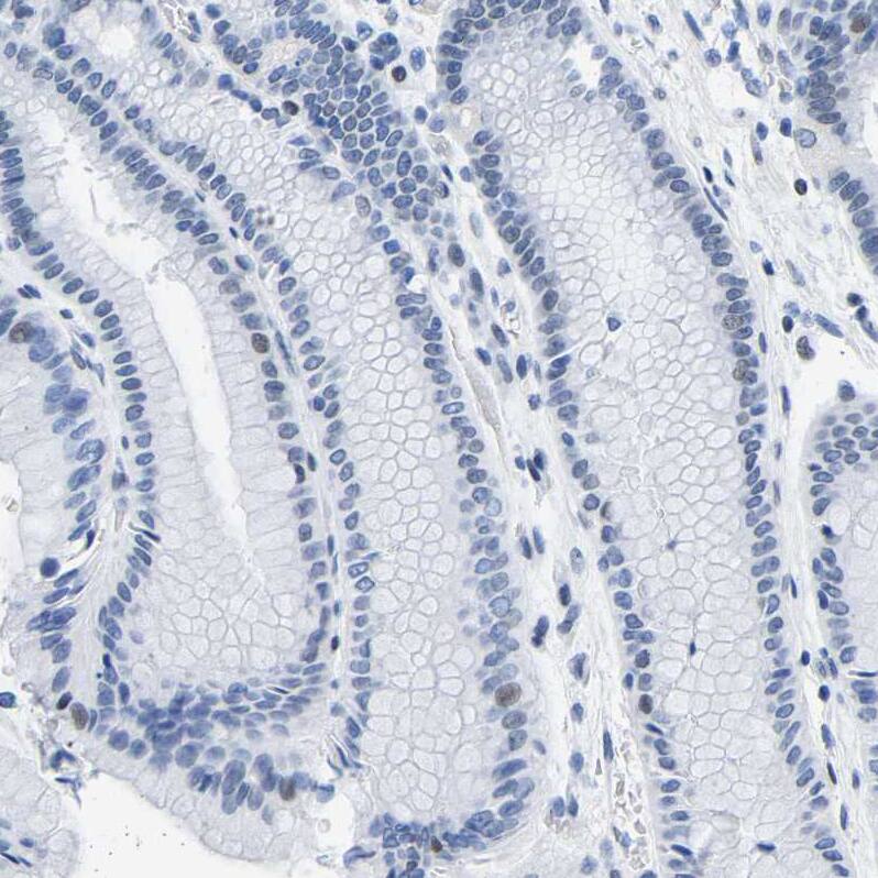Immunohistochemistry-Paraffin Uroplakin III Antibody - BSA Free