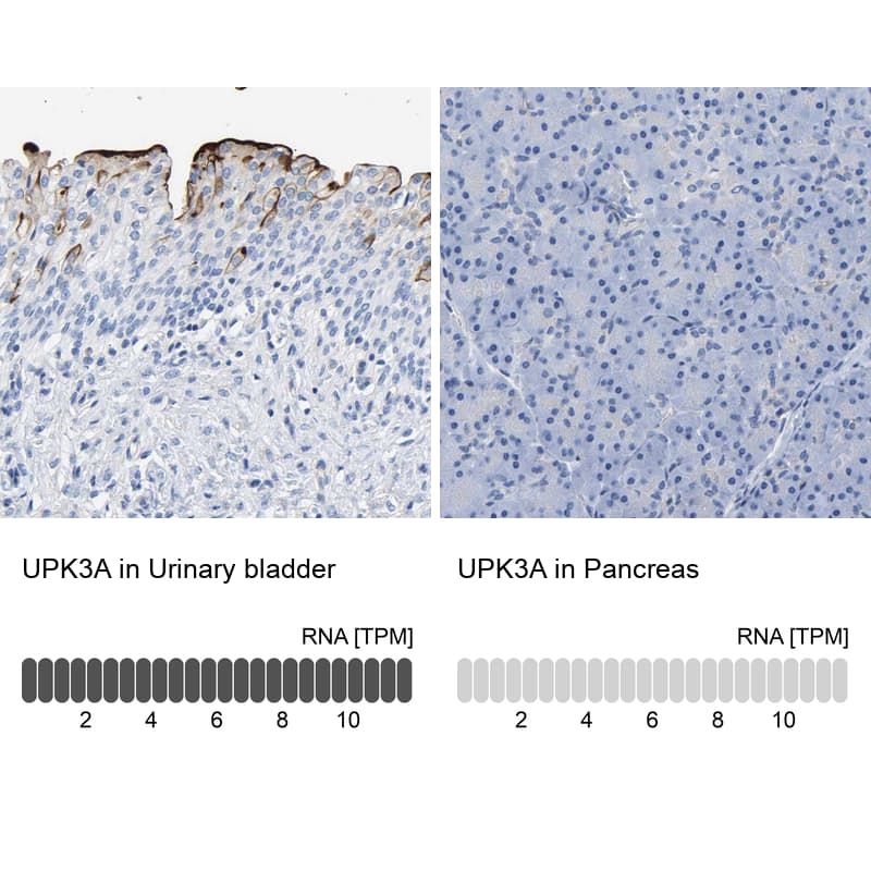 <b>Orthogonal Strategies Validation. </b>Analysis in human urinary bladder and pancreas tissues Corresponding UPK3A RNA-seq data are presented for the same tissues.