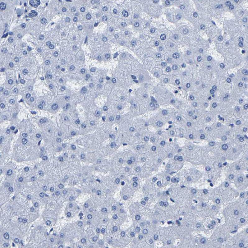 Staining of human liver shows no positivity in hepatocytes as expected.