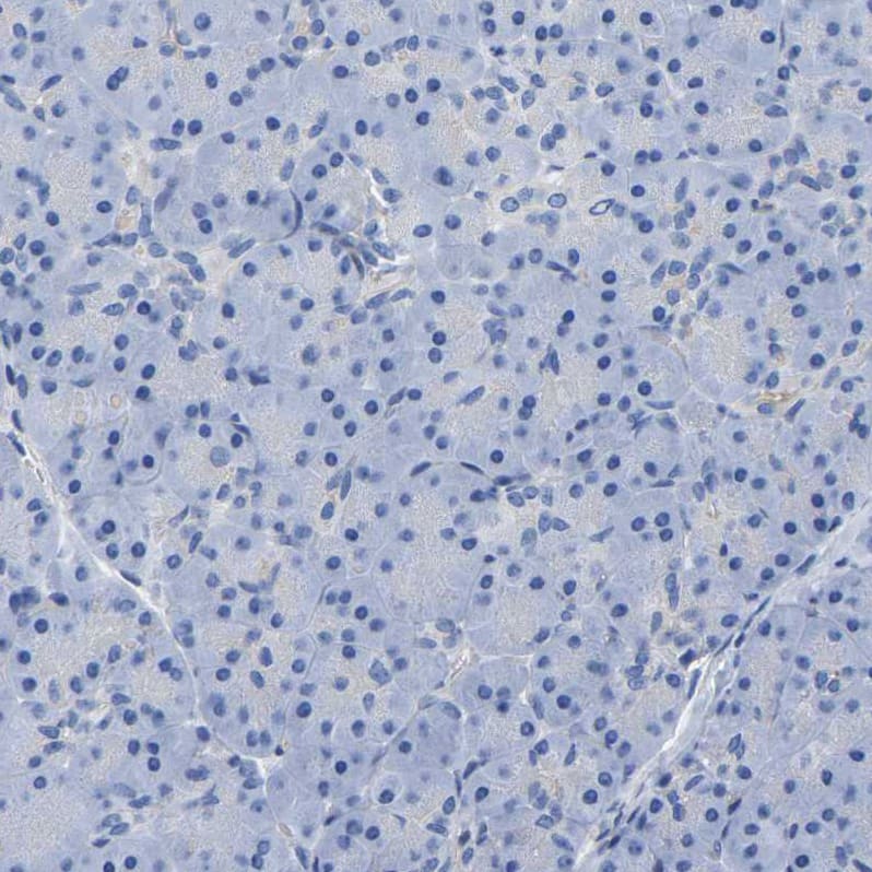 Immunohistochemistry-Paraffin Uroplakin III Antibody - BSA Free