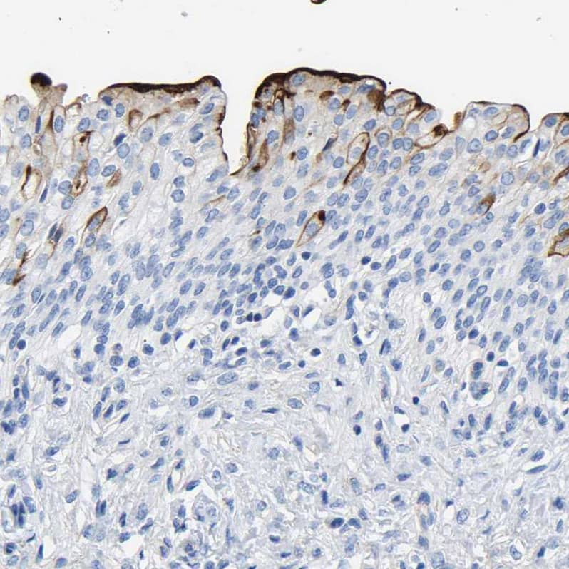 Staining of human urinary bladder shows strong cytoplasmic positivity in urothelial cells.