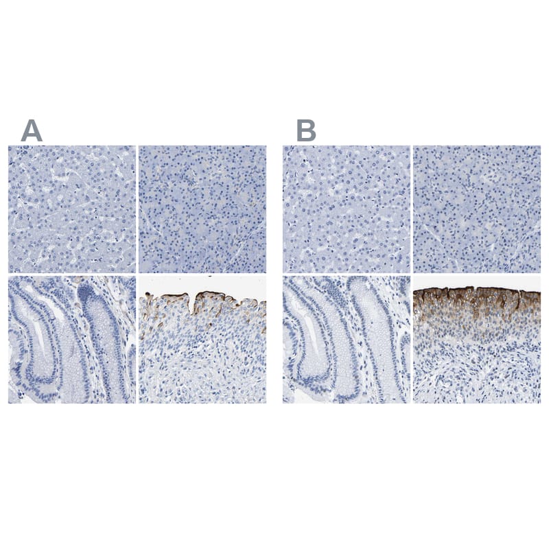 <b>Independent Antibodies Validation. </b>Staining of human liver, pancreas, stomach and urinary bladder using Anti-UPK3A antibody NBP1-86874 (A) shows similar protein distribution across tissues to independent antibody NBP1-86873 (B).