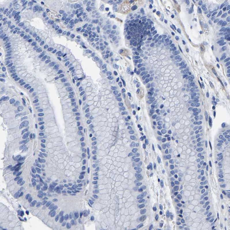 Staining of human stomach shows no positivity in glandular cells as expected.
