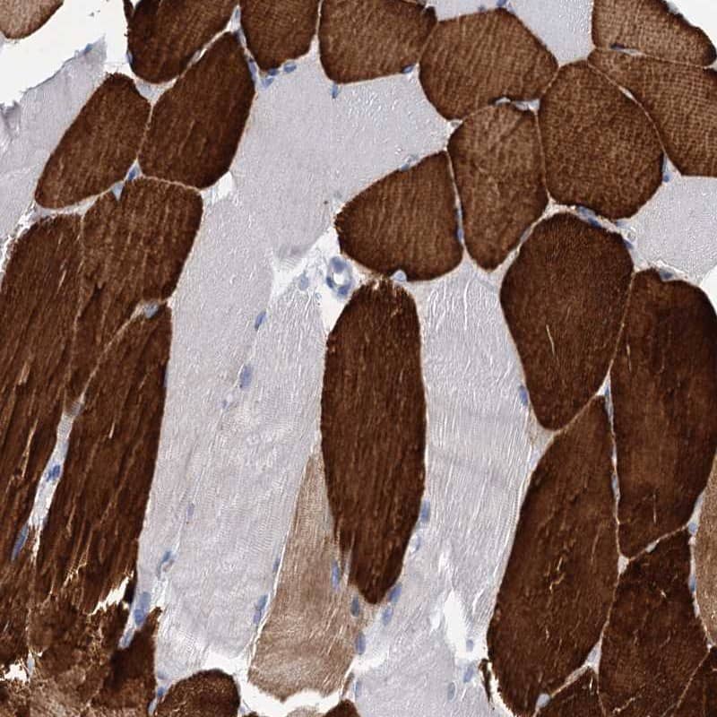 Staining of human skeletal muscle shows strong cytoplasmic positivity in myocytes.